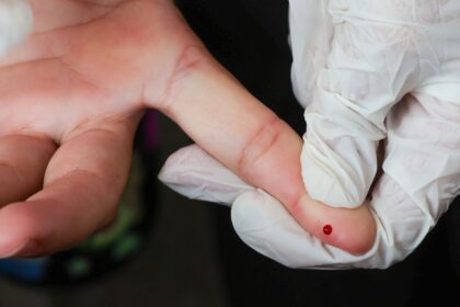 brasil-atinge-meta-de-reducao-da-transmissao-vertical-de-hepatite-b