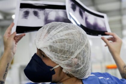 diagnostico-tardio-da-poucas-chances-de-cura-para-o-cancer-de-pulmao