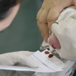 atraso-na-ampliacao-do-teste-do-pezinho-dificulta-diagnostico-da-ame