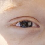 baixa-visao-na-infancia:-especialista-alerta-para-diagnostico-precoce
