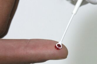 fiji-declara-emergencia-nacional-por-hiv-com-1-caso-a-cada-60-pessoas