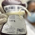 saude-aprova-protocolo-para-tratar-criancas-com-hemofilia-a
